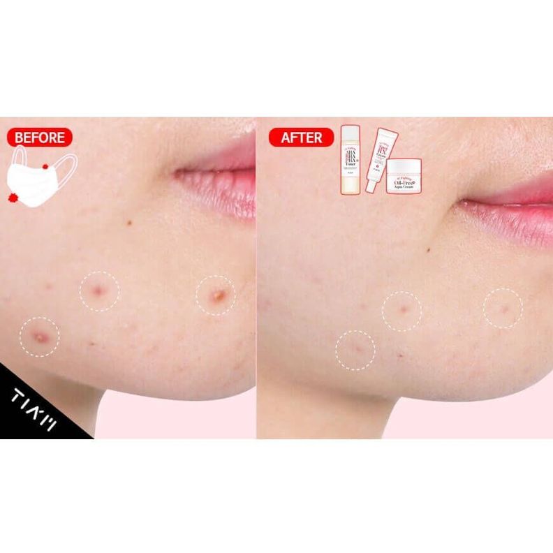 Crema calmante con Niancinamida y Zinc-2